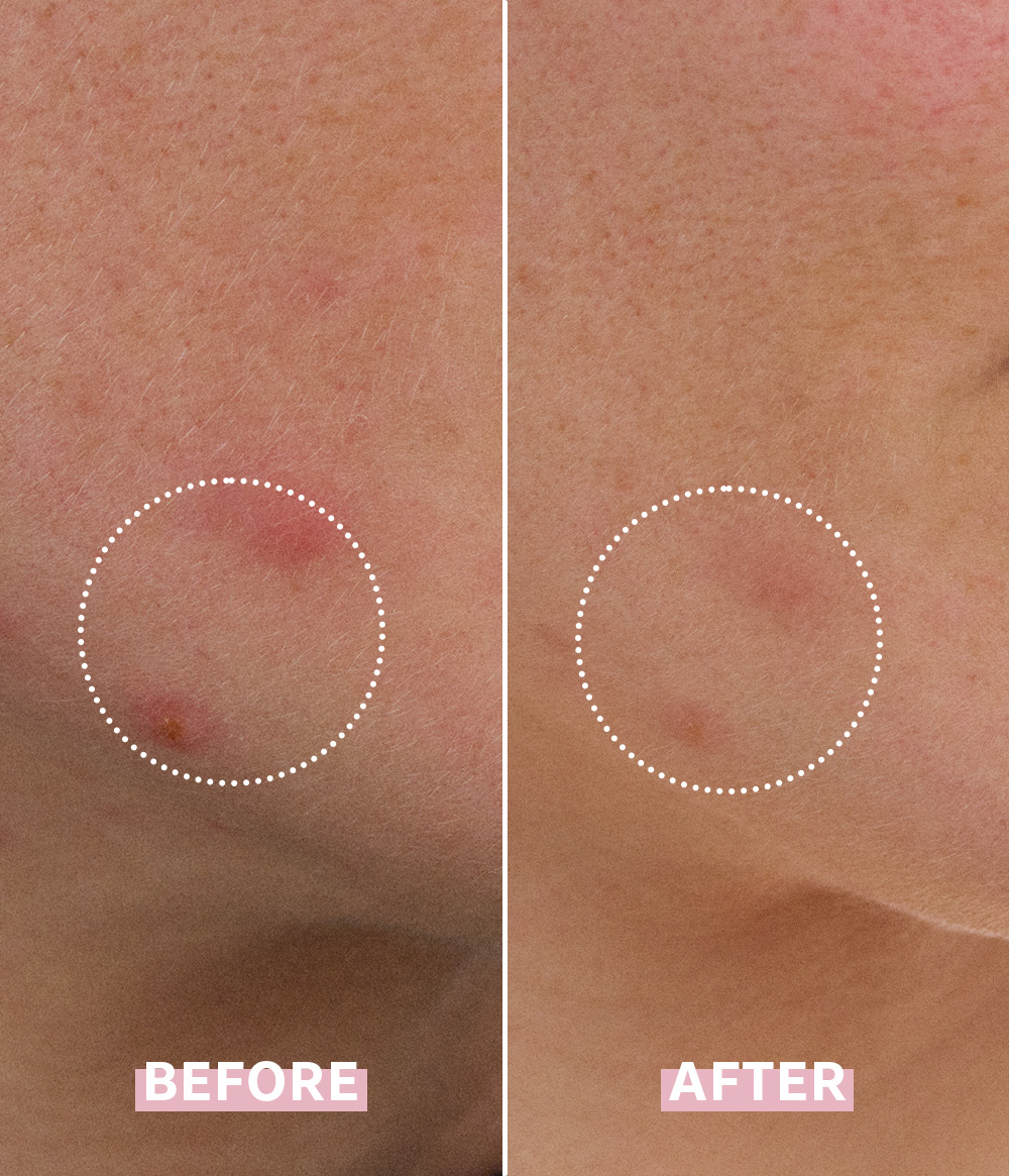 OH MY CICA SPOT GEL CREAM